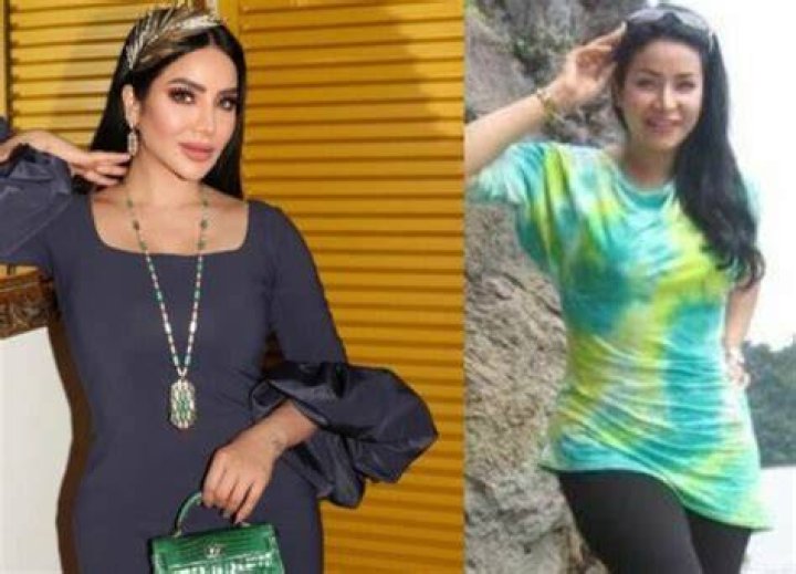 All About Lojain Omran Plastic Surgery With Her Before And After Photos