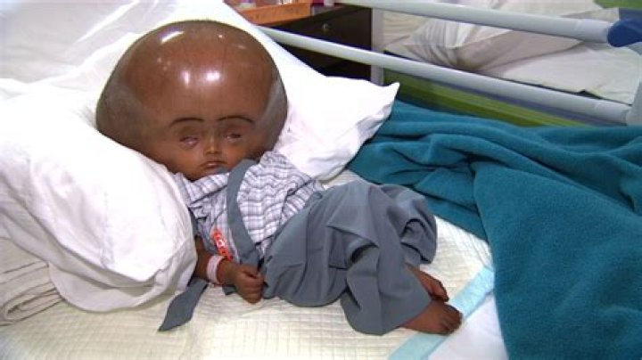 Roona Begum Wikipedia: Baby Roona Death: How Did She Die?