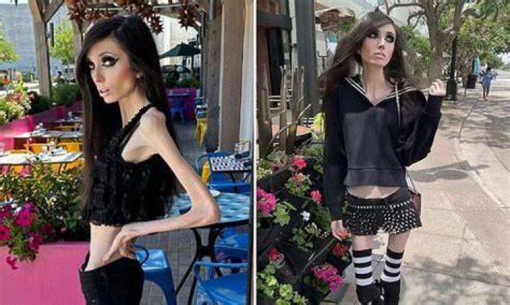 Unveiling Eugenia Cooney's Journey: Insights Into Anorexia Recovery